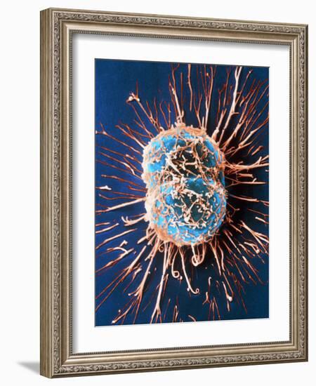 Cervical Cancer Cells Dividing-Steve Gschmeissner-Framed Photographic Print