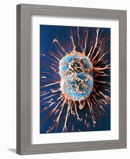 Cervical Cancer Cells Dividing-Steve Gschmeissner-Framed Photographic Print