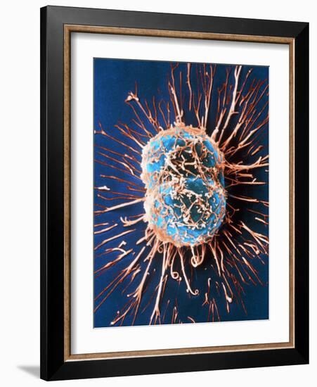 Cervical Cancer Cells Dividing-Steve Gschmeissner-Framed Photographic Print