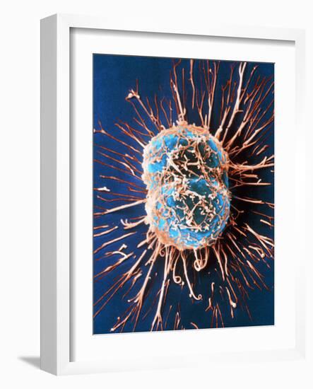 Cervical Cancer Cells Dividing-Steve Gschmeissner-Framed Photographic Print