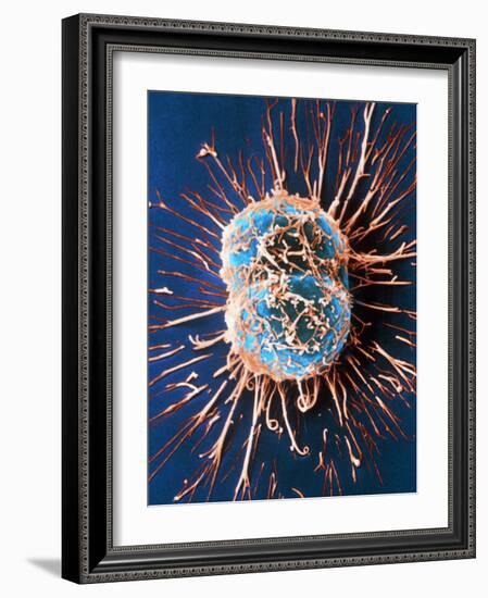 Cervical Cancer Cells Dividing-Steve Gschmeissner-Framed Photographic Print