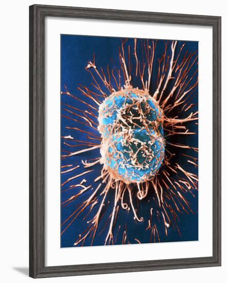 Cervical Cancer Cells Dividing-Steve Gschmeissner-Framed Photographic Print