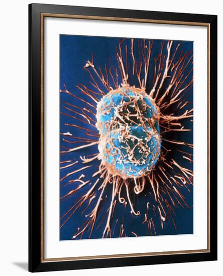 Cervical Cancer Cells Dividing-Steve Gschmeissner-Framed Photographic Print