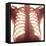 Chest X-ray of a Healhty Human Heart-Science Photo Library-Framed Premier Image Canvas