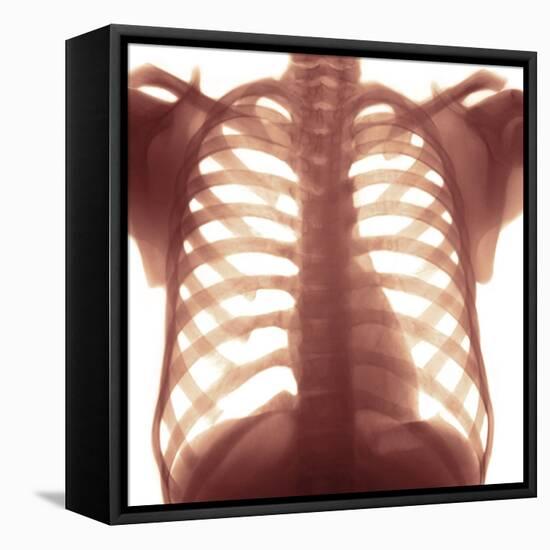 Chest X-ray of a Healhty Human Heart-Science Photo Library-Framed Premier Image Canvas