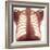 Chest X-ray of a Healhty Human Heart-Science Photo Library-Framed Premium Photographic Print