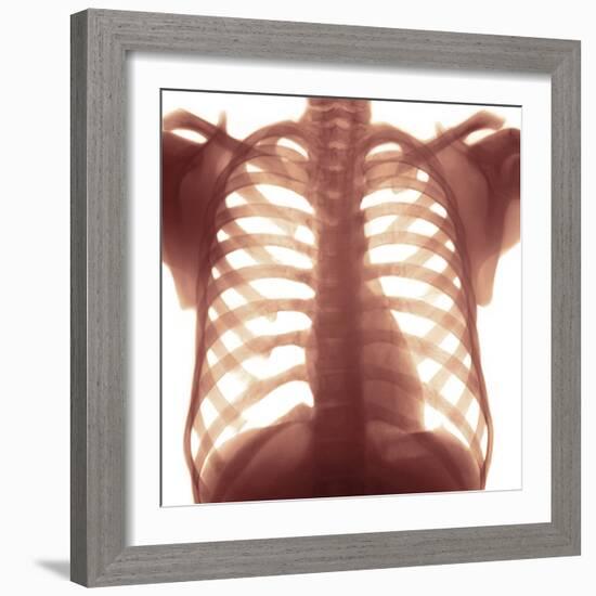 Chest X-ray of a Healhty Human Heart-Science Photo Library-Framed Premium Photographic Print