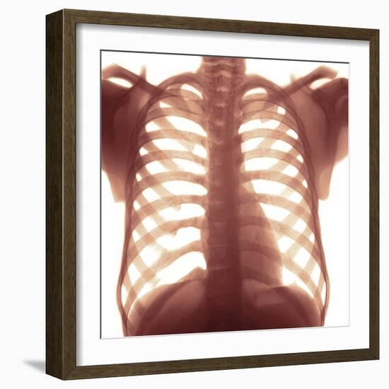 Chest X-ray of a Healhty Human Heart-Science Photo Library-Framed Premium Photographic Print