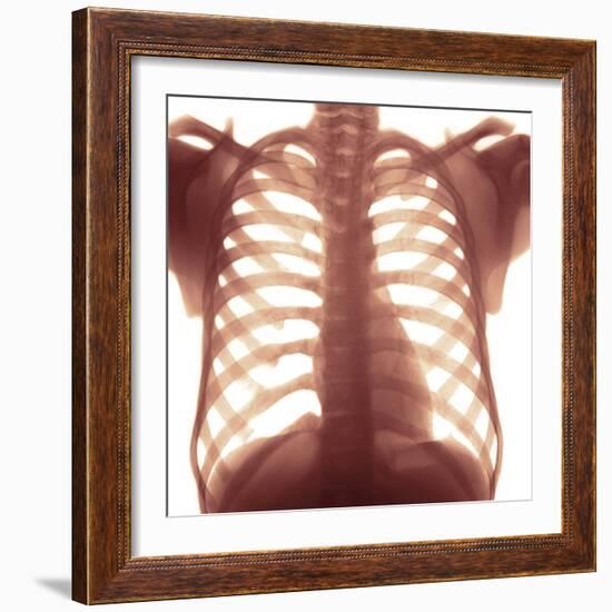 Chest X-ray of a Healhty Human Heart-Science Photo Library-Framed Premium Photographic Print