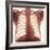Chest X-ray of a Healhty Human Heart-Science Photo Library-Framed Premium Photographic Print