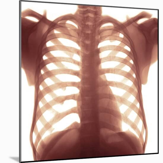 Chest X-ray of a Healhty Human Heart-Science Photo Library-Mounted Premium Photographic Print