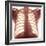 Chest X-ray of a Healhty Human Heart-Science Photo Library-Framed Premium Photographic Print