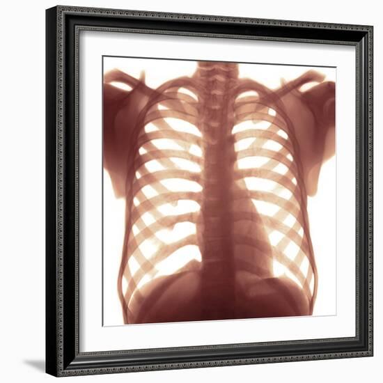 Chest X-ray of a Healhty Human Heart-Science Photo Library-Framed Premium Photographic Print