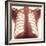 Chest X-ray of a Healhty Human Heart-Science Photo Library-Framed Premium Photographic Print