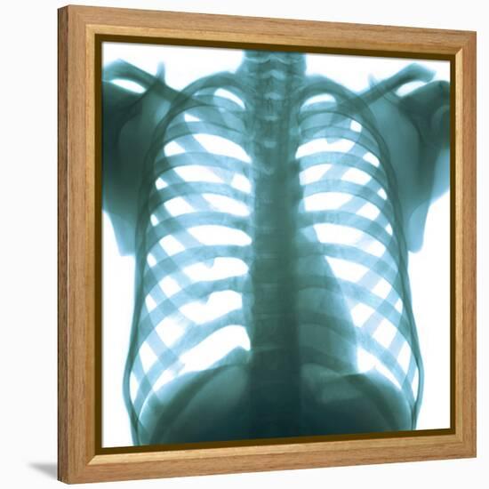 Chest X-ray of a Healthy Human Heart-Science Photo Library-Framed Premier Image Canvas