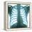 Chest X-ray of a Healthy Human Heart-Science Photo Library-Framed Premier Image Canvas