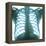 Chest X-ray of a Healthy Human Heart-Science Photo Library-Framed Premier Image Canvas