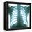 Chest X-ray of a Healthy Human Heart-Science Photo Library-Framed Premier Image Canvas