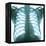Chest X-ray of a Healthy Human Heart-Science Photo Library-Framed Premier Image Canvas