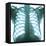 Chest X-ray of a Healthy Human Heart-Science Photo Library-Framed Premier Image Canvas