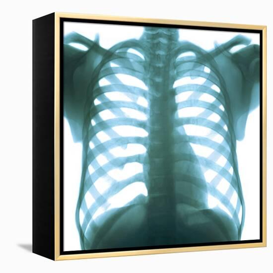 Chest X-ray of a Healthy Human Heart-Science Photo Library-Framed Premier Image Canvas