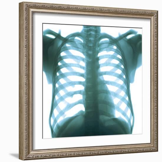 Chest X-ray of a Healthy Human Heart-Science Photo Library-Framed Premium Photographic Print