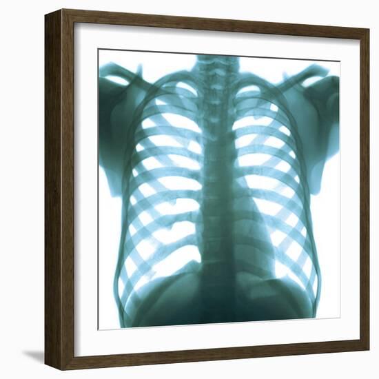 Chest X-ray of a Healthy Human Heart-Science Photo Library-Framed Premium Photographic Print