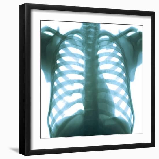 Chest X-ray of a Healthy Human Heart-Science Photo Library-Framed Premium Photographic Print