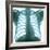 Chest X-ray of a Healthy Human Heart-Science Photo Library-Framed Premium Photographic Print