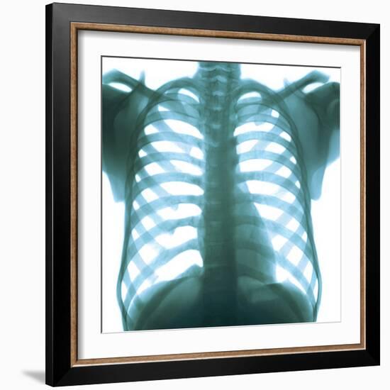 Chest X-ray of a Healthy Human Heart-Science Photo Library-Framed Premium Photographic Print