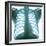 Chest X-ray of a Healthy Human Heart-Science Photo Library-Framed Premium Photographic Print