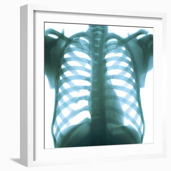 Chest X-ray of a Healthy Human Heart-Science Photo Library-Framed Premium Photographic Print