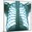 Chest X-ray of a Healthy Human Heart-Science Photo Library-Mounted Premium Photographic Print