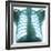 Chest X-ray of a Healthy Human Heart-Science Photo Library-Framed Premium Photographic Print