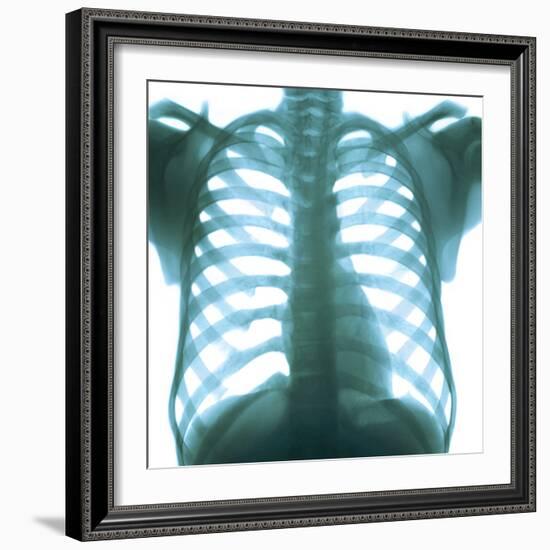 Chest X-ray of a Healthy Human Heart-Science Photo Library-Framed Premium Photographic Print