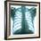 Chest X-ray of a Healthy Human Heart-Science Photo Library-Framed Premium Photographic Print