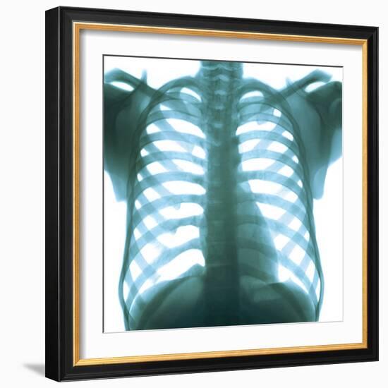 Chest X-ray of a Healthy Human Heart-Science Photo Library-Framed Premium Photographic Print