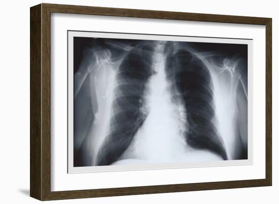 Chest-null-Framed Premium Giclee Print