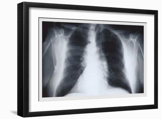 Chest-null-Framed Premium Giclee Print