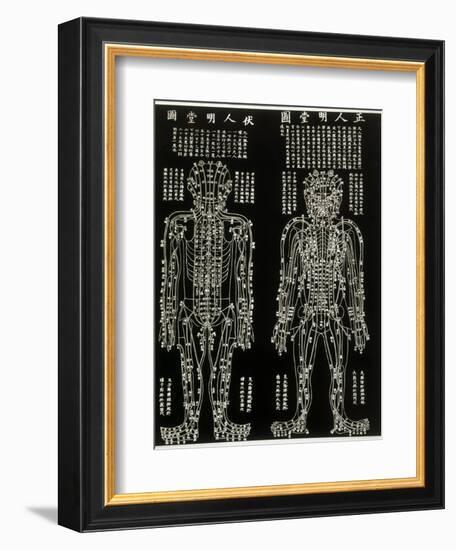 Chinese Acupuncture Chart Showing the Crucial Locations on the Body-null-Framed Photographic Print