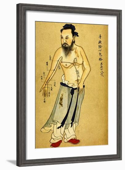 Chinese Acupuncture Charts-null-Framed Art Print