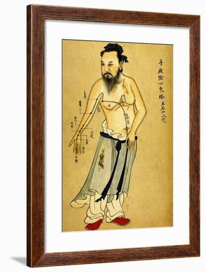 Chinese Acupuncture Charts-null-Framed Art Print