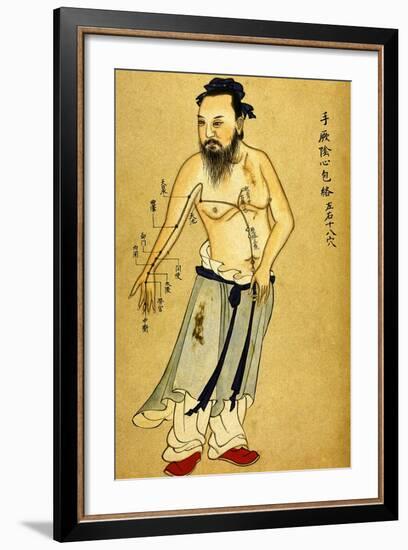 Chinese Acupuncture Charts-null-Framed Art Print