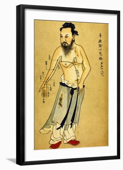 Chinese Acupuncture Charts-null-Framed Art Print