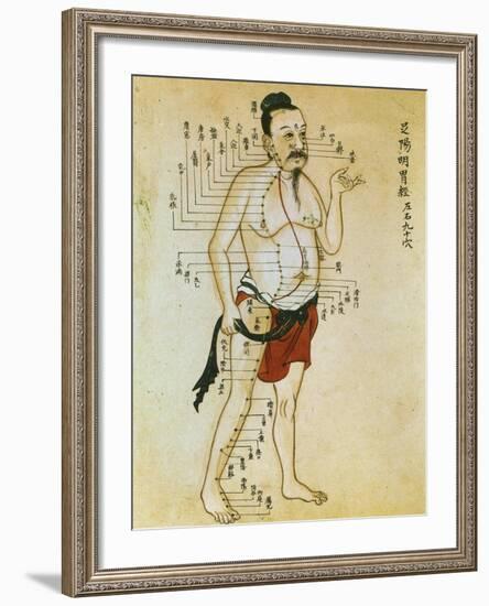 Chinese Acupuncture Charts-null-Framed Art Print