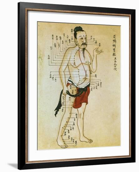 Chinese Acupuncture Charts-null-Framed Art Print