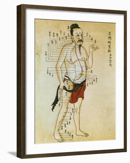 Chinese Acupuncture Charts-null-Framed Art Print