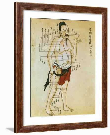 Chinese Acupuncture Charts-null-Framed Art Print