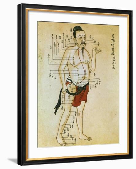 Chinese Acupuncture Charts-null-Framed Art Print