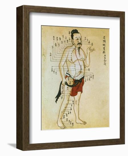 Chinese Acupuncture Charts-null-Framed Art Print